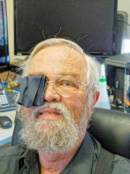 https://lemis.nyc3.digitaloceanspaces.com/grog/Photos/20240324/small/Greg-with-eye-patch-2.jpeg