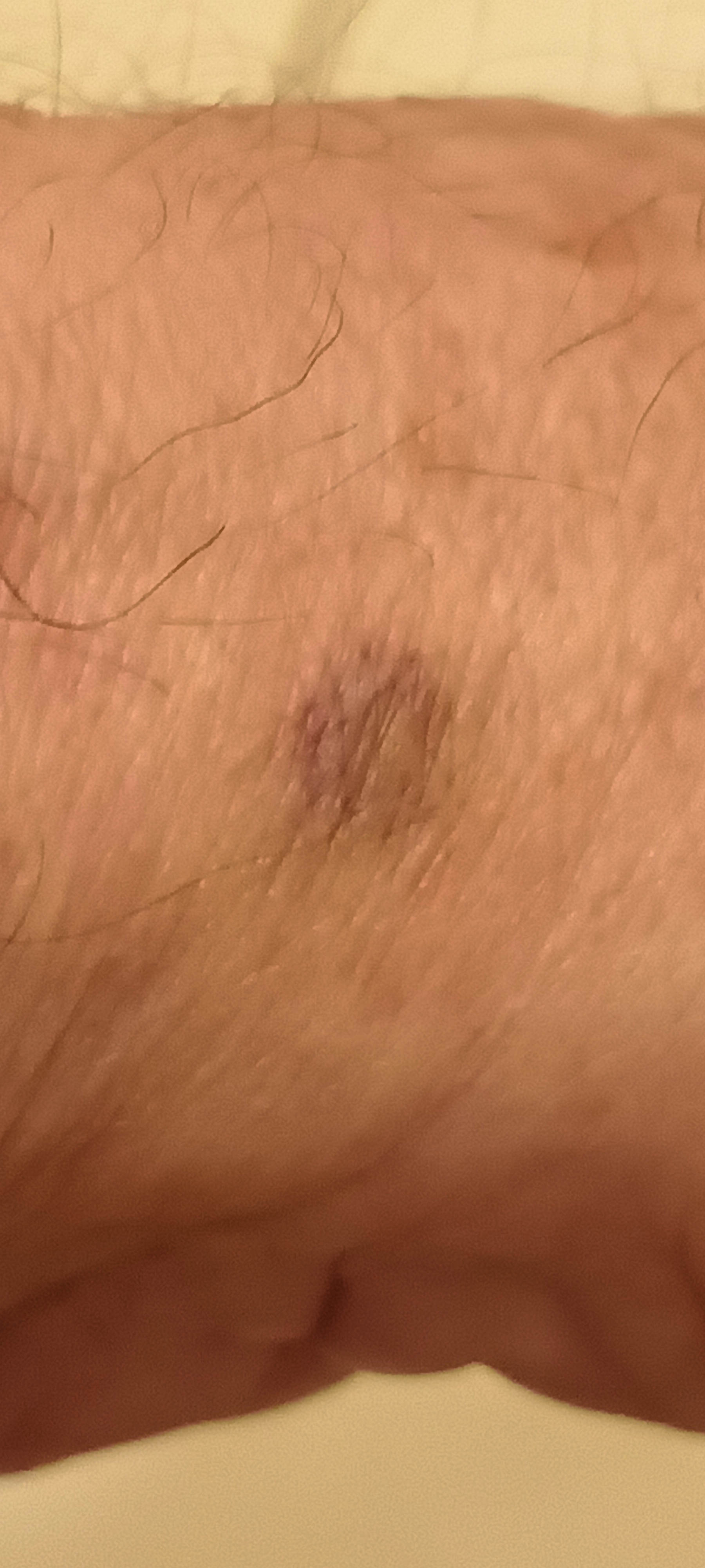 Photo Gregs-wrist-2.jpeg.  Click to redisplay small version of image. https://lemis.nyc3.digitaloceanspaces.com/grog/Photos/20251024/big/Gregs-wrist-2.jpeg